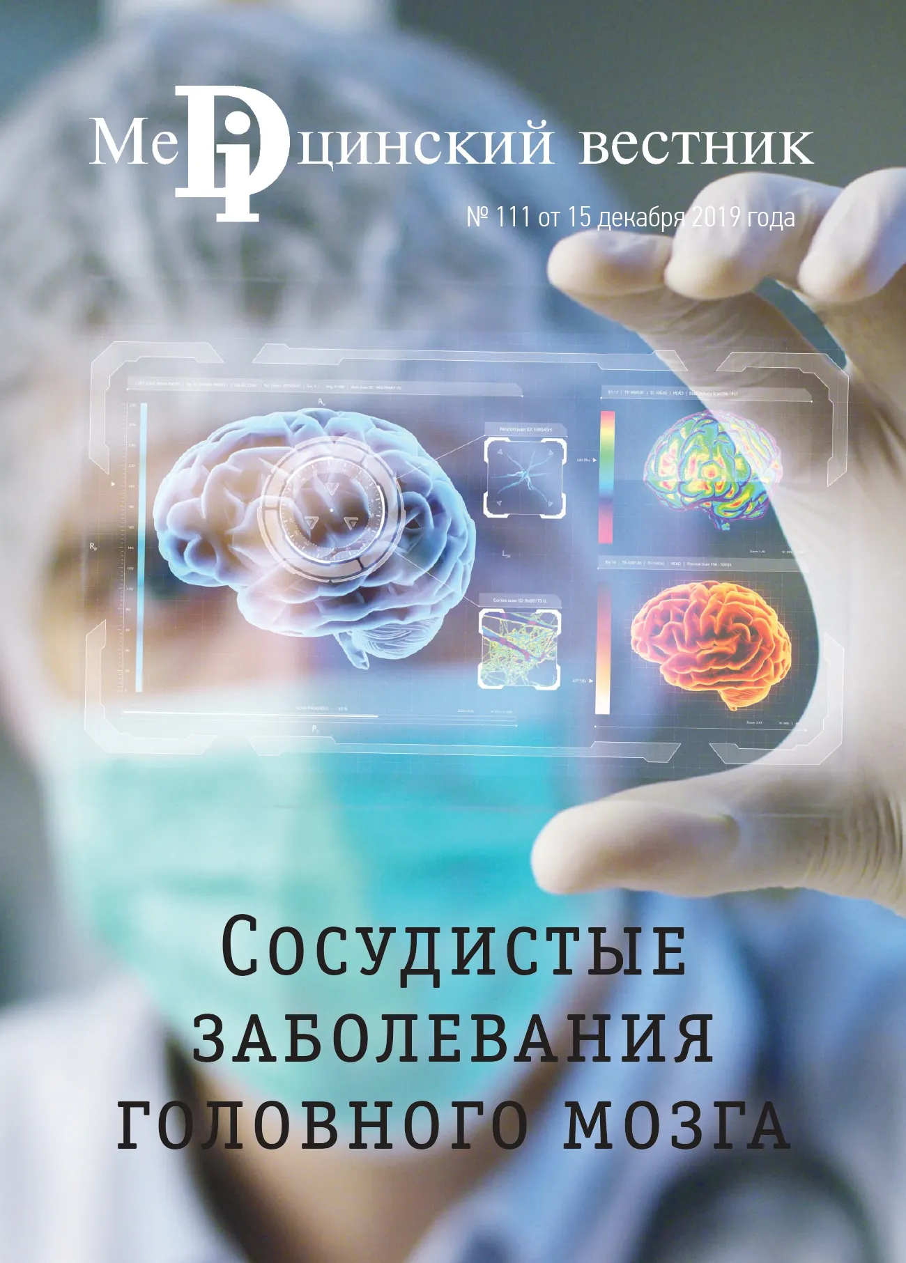 Журнал Сосудистые заболевания головного мозга, 15 января, 2020
